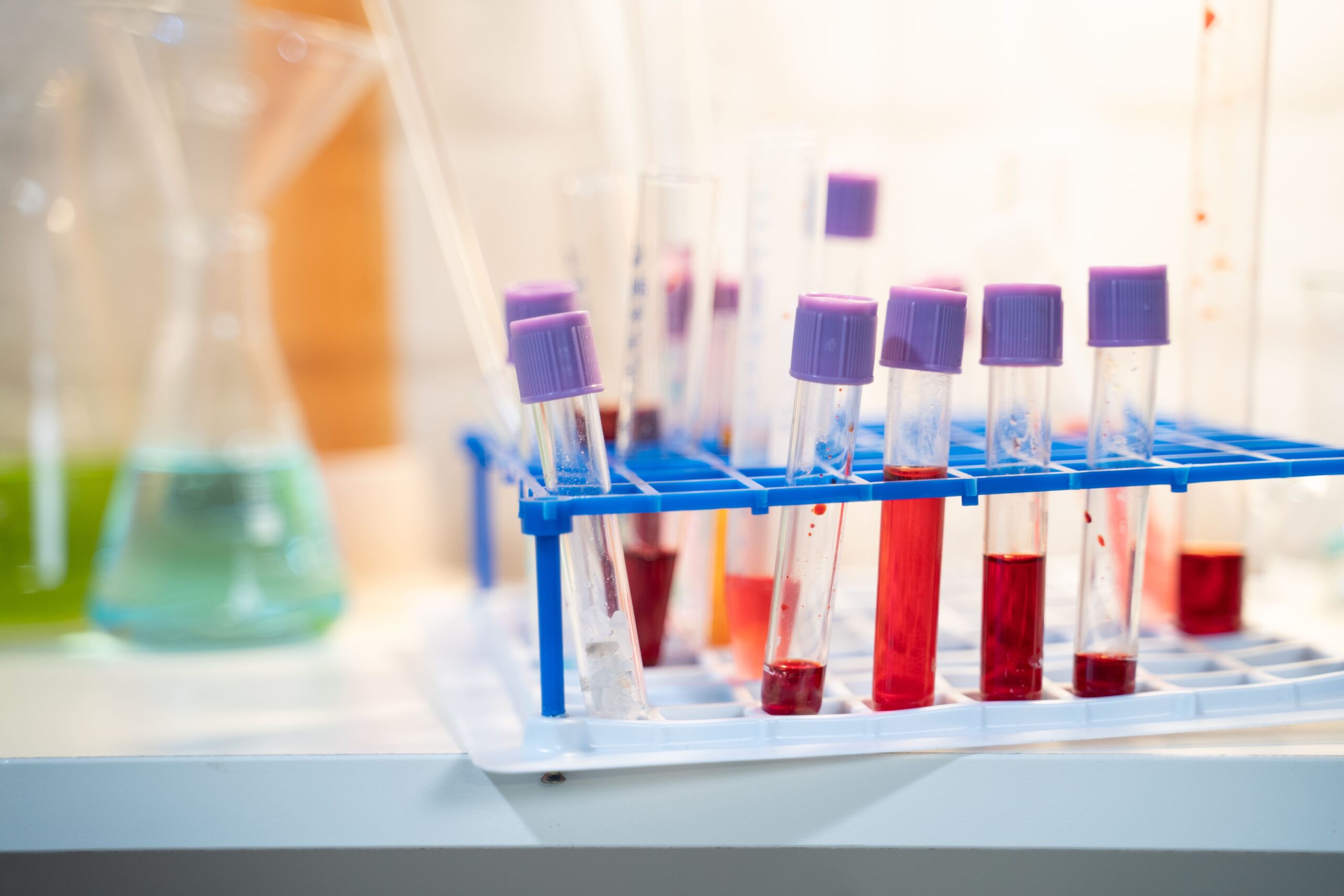 Research Reagents